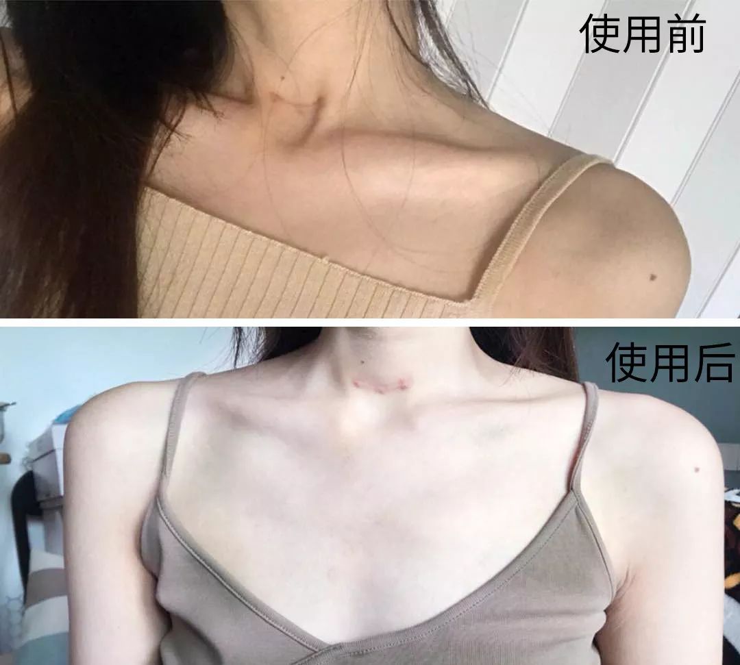 为什么夏天不露腿了,夏天不露腿热吗