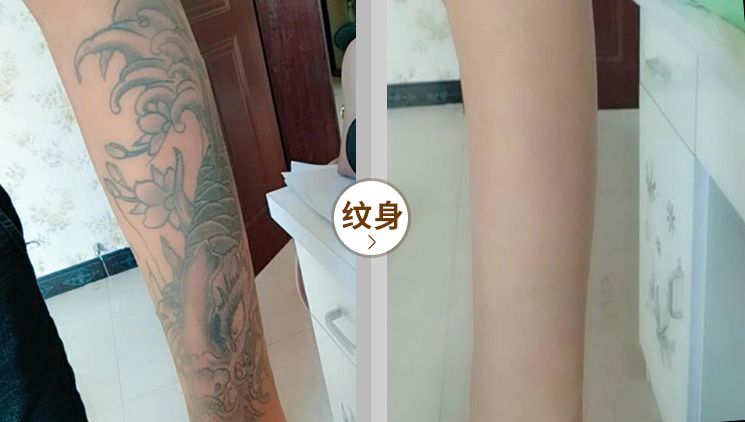 为什么夏天不露腿了,夏天不露腿热吗