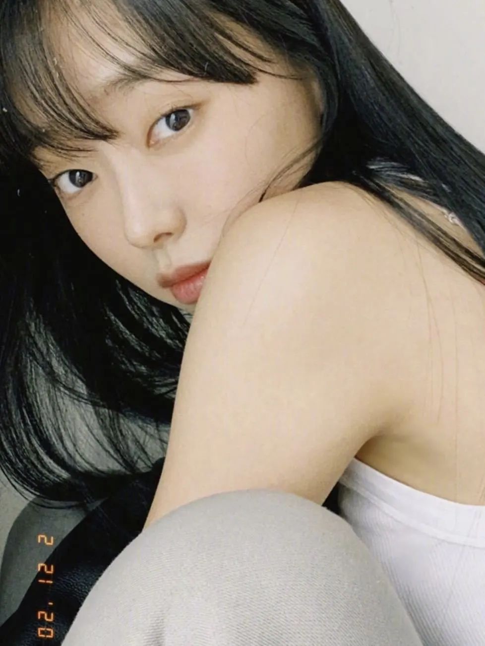 开完双眼皮为什么要往上看,开过的双眼皮可以再埋线吗