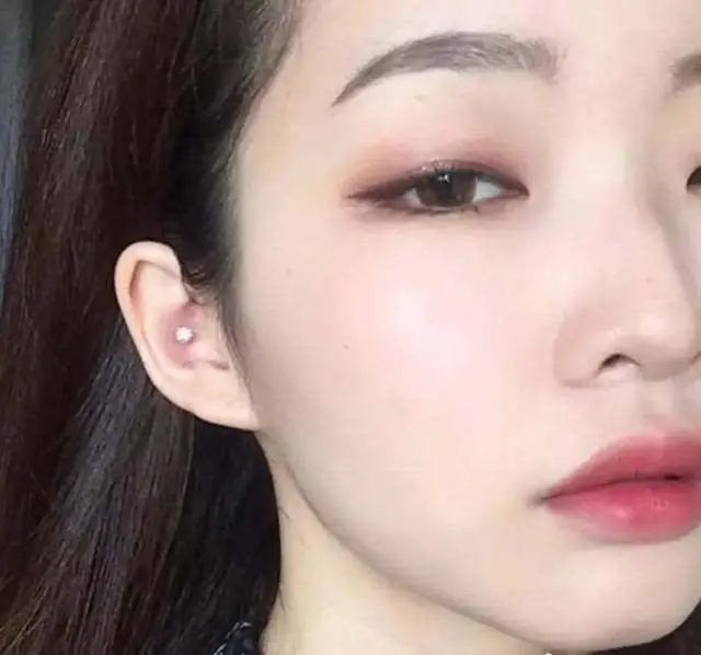 开完双眼皮为什么要往上看,开过的双眼皮可以再埋线吗