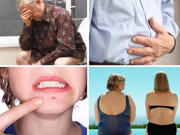 口臭痘痘胃脘疼便秘,痘痘多口臭怎么办