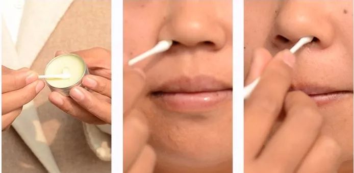 过敏了鼻炎鼻塞严重,过敏鼻炎十年不治会怎样