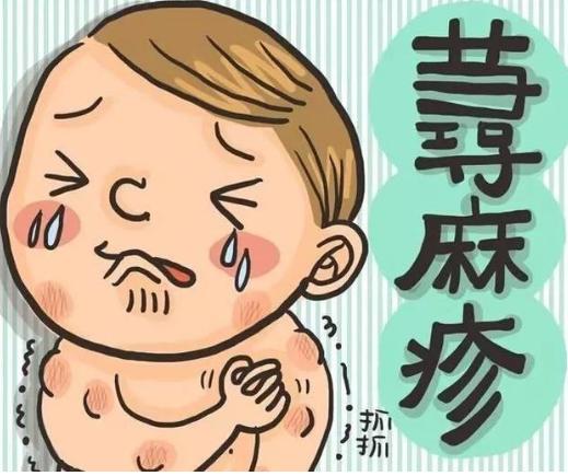 麻疹防控温馨提示,春季麻疹预防小知识图片