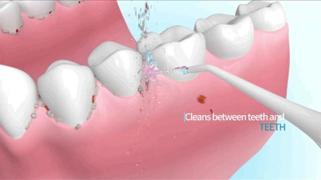 最好用的冲牙神器,推荐一款超级小巧的冲牙器