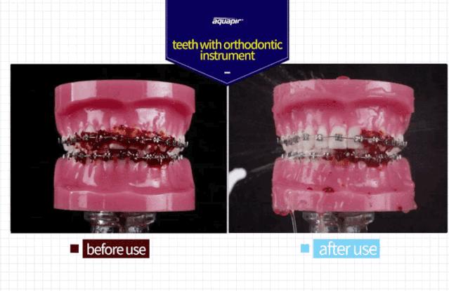 最好用的冲牙神器,推荐一款超级小巧的冲牙器