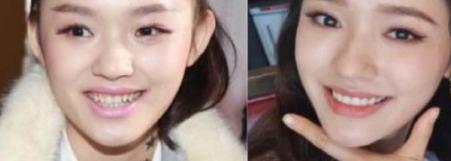 羡慕别人一口好牙,羡慕有一口好牙的人