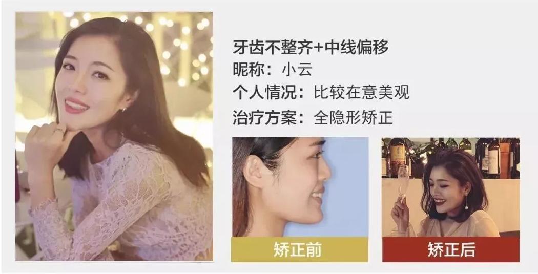 羡慕别人一口好牙,羡慕有一口好牙的人