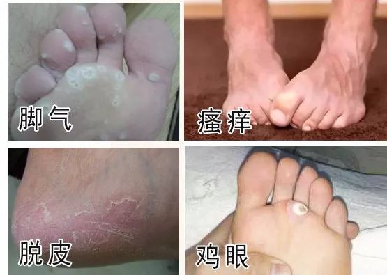 脚臭袜冰丝材质透气不闷脚,秋冬透气不臭脚棉袜