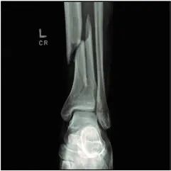 珠江视界|麻醉学科相关最新重要文献导读(2020.06)