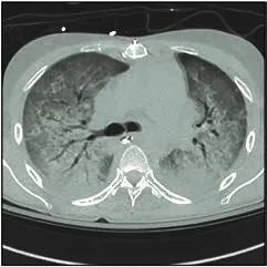 珠江视界|麻醉学科相关最新重要文献导读(2020.06)