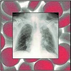 珠江视界|麻醉学科相关最新重要文献导读(2020.06)