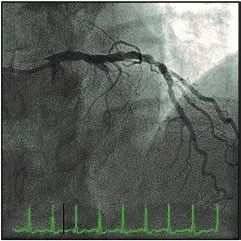 珠江视界|麻醉学科相关最新重要文献导读(2020.06)