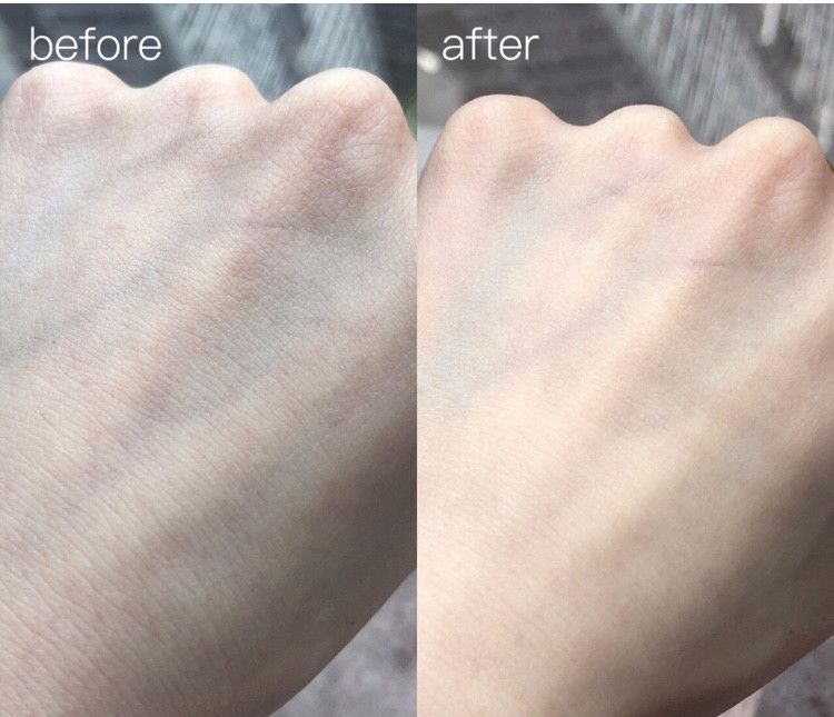 鼻头痘痘挤出来的白色物质是什么,团状红痘痘