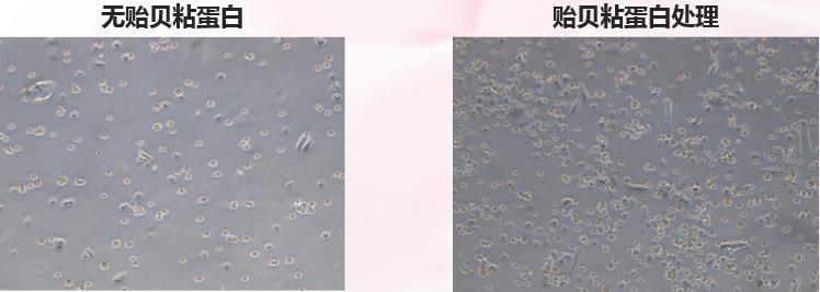 25岁以上要注意哪些保养,25岁之后应注意保养哪些部位