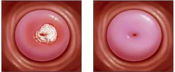 25岁以上要注意哪些保养,25岁之后应注意保养哪些部位