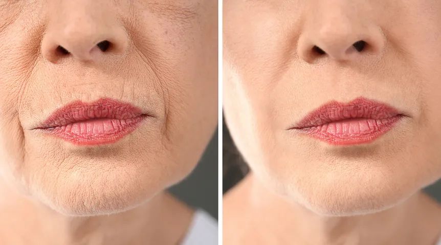 让你长纹又长斑的「杀手」，就藏在你的身体里