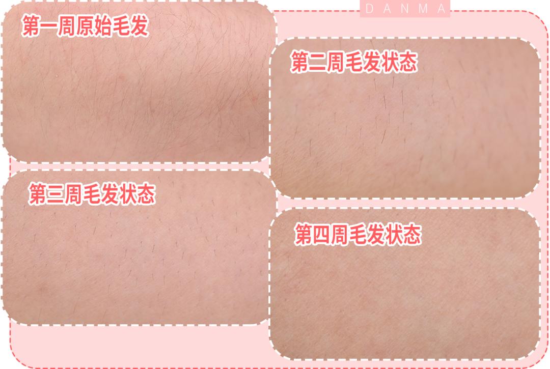 真实脱毛测评,官方测评真正有用的脱毛仪