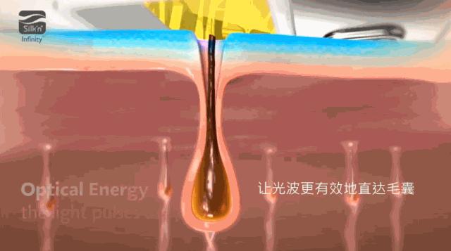 真实脱毛测评,官方测评真正有用的脱毛仪