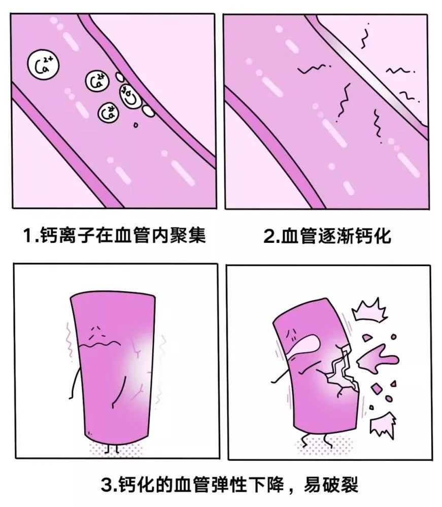 维生素k2钙入骨,骨质疏松维生素k2