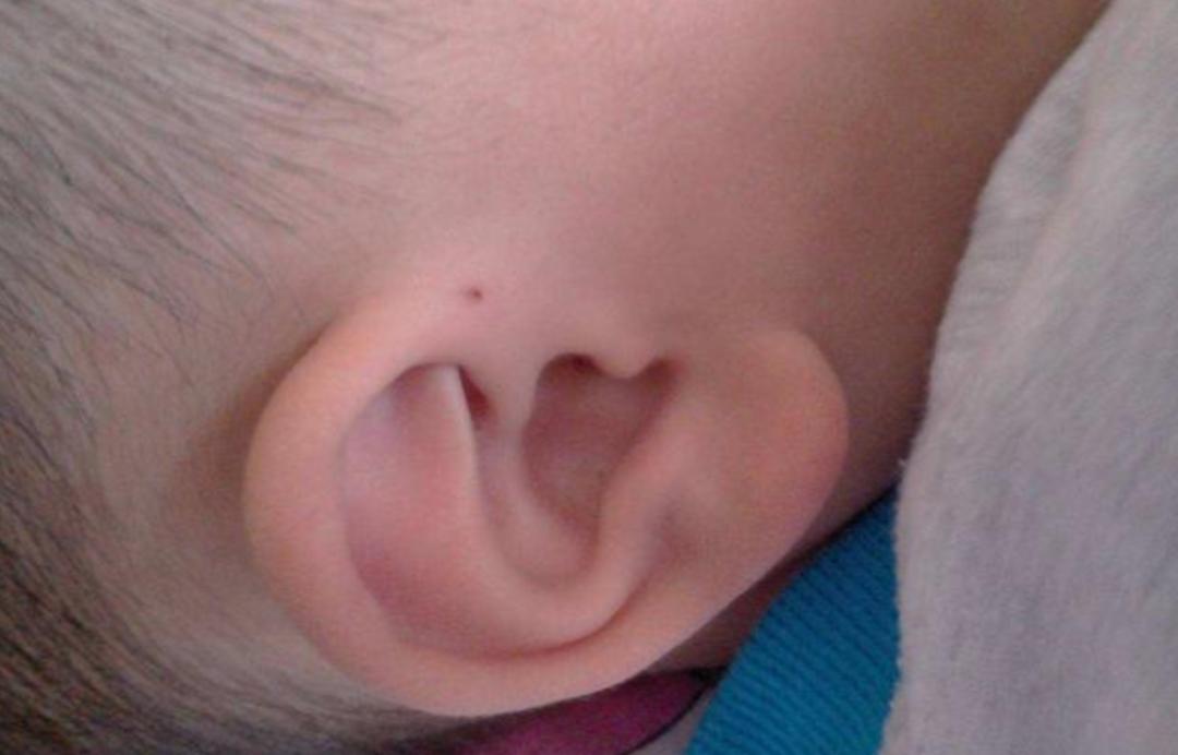 宝宝聪明洞,宝宝有聪明智慧