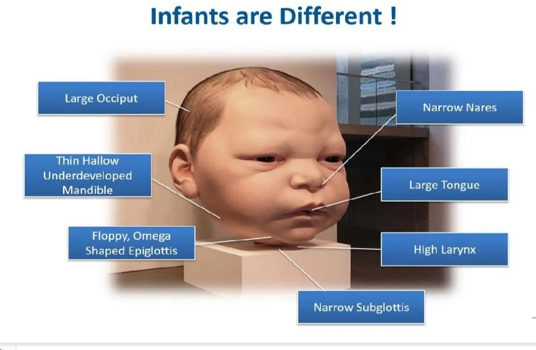 气道异物患者麻醉,小儿气道异物麻醉