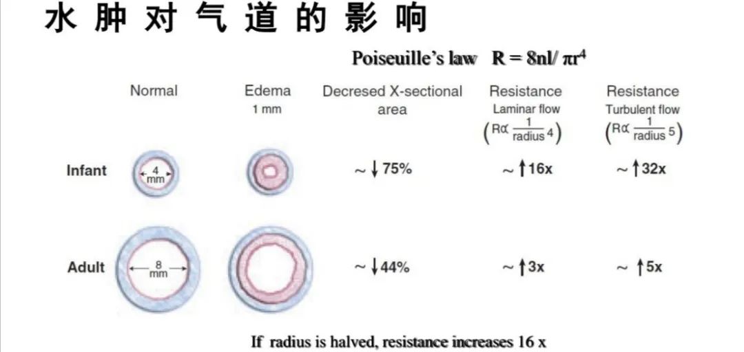 气道异物患者麻醉,小儿气道异物麻醉