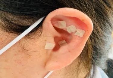 岳阳医院冬病夏治,中医养生保健冬病夏治