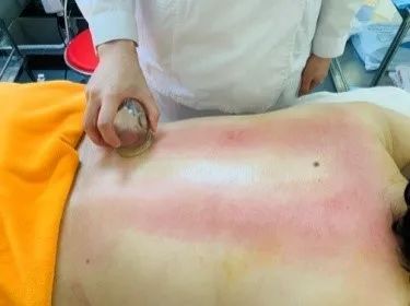 岳阳医院冬病夏治,中医养生保健冬病夏治