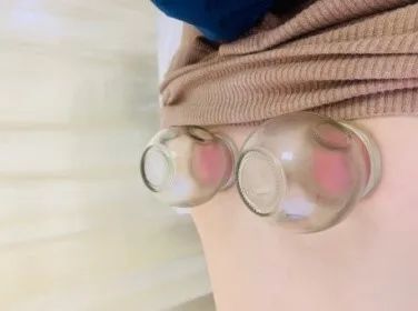 岳阳医院冬病夏治,中医养生保健冬病夏治