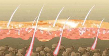 7天挑战无头屑,挑战5天不洗头依旧蓬松不油头
