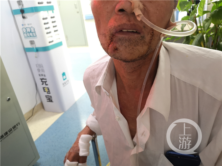 中国男子用牙齿咬电线被电身亡,牙齿咬电线触电