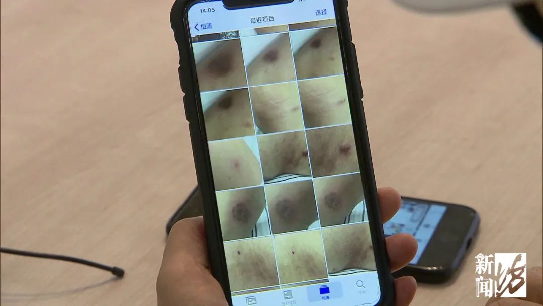 年近70的丈夫为美容疯狂花掉576万,70岁老人为美容疯狂花576万