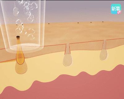 11块钱淡斑体验,1元享受美容养生护理无隐形消费