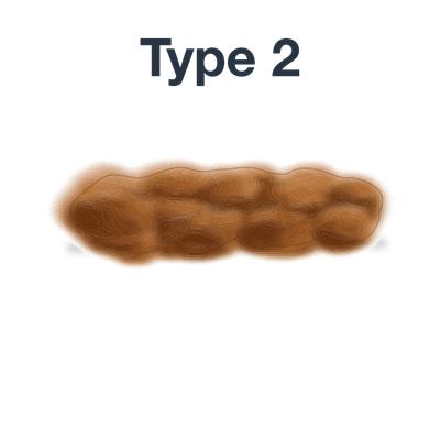 最近大便稀粘稠粘马桶,马桶粘大便有什么妙招