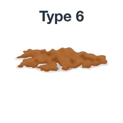 最近大便稀粘稠粘马桶,马桶粘大便有什么妙招