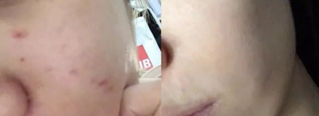 日本减肥小粉丸一盒400粒,日本小粉丸一盒400粒