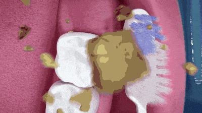 便宜哭了！日本人都在用的变态牙刷，竟然比洗牙还白，牙垢、牙龈出血全解决，嘴巴里脏东西洗出来后，太清爽了