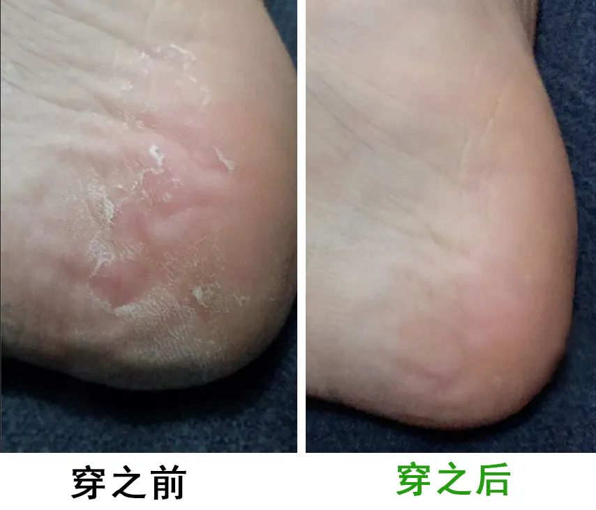 脚臭袜冰丝材质透气不闷脚,秋冬透气不臭脚棉袜