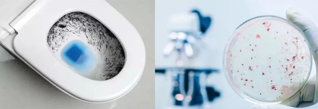 马桶又脏又臭教你一招轻松解决,马桶脏臭有黄渍刷子刷不掉