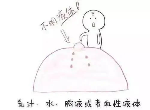 导管健康教育科普短视频,导管室健康科普