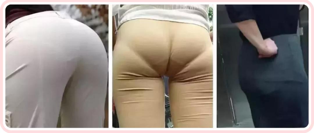 女性妇科病和内裤有关,女性容易得妇科病和内裤有关系吗