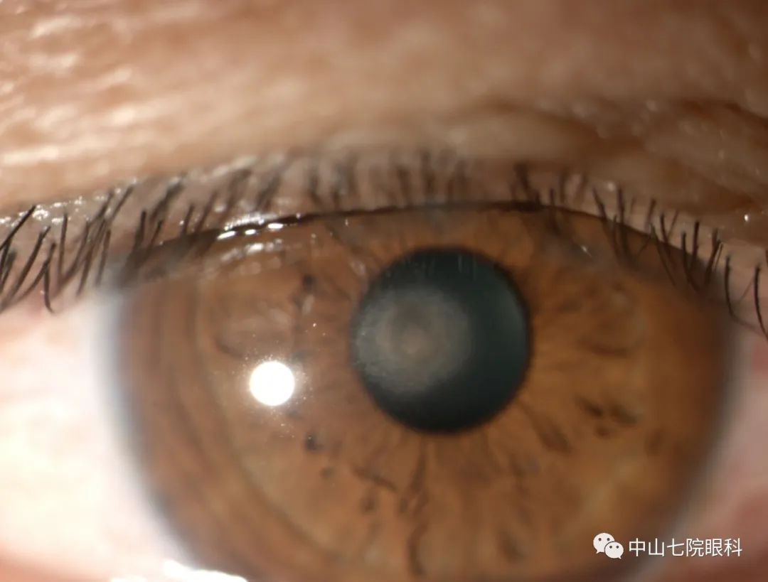 眼睛受外伤还能痊愈吗,眼睛受外伤的紧急处理办法