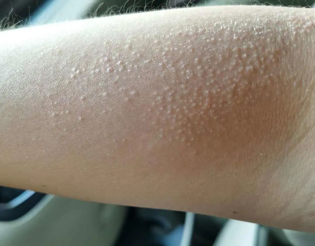 防晒是最重要的事,防晒这点事儿