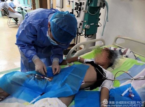 咸阳彩虹医院透析室,咸阳彩虹医院儿童康复科