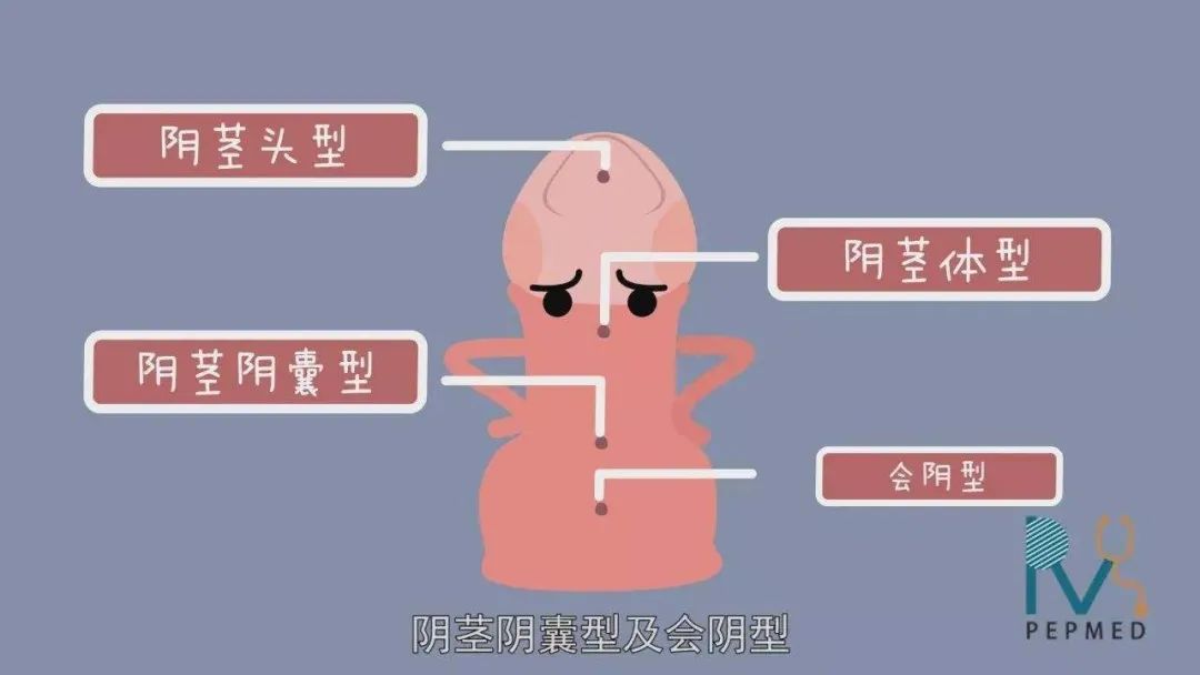 泌尿健康科普知识宣教,泌尿医学知识科普视频