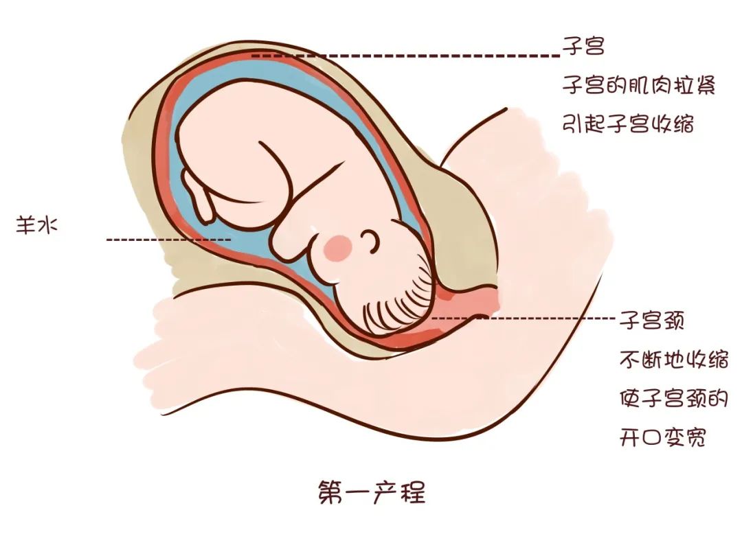 分娩镇痛工作思路,分娩镇痛规范及流程ppt