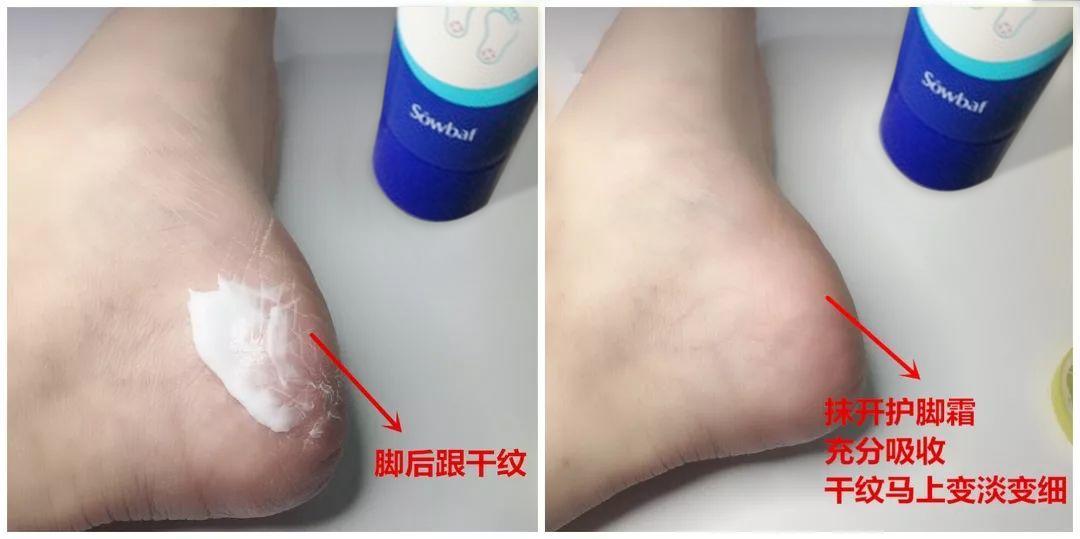 一招告别死皮老茧脚,去脚后跟老茧死皮的法子