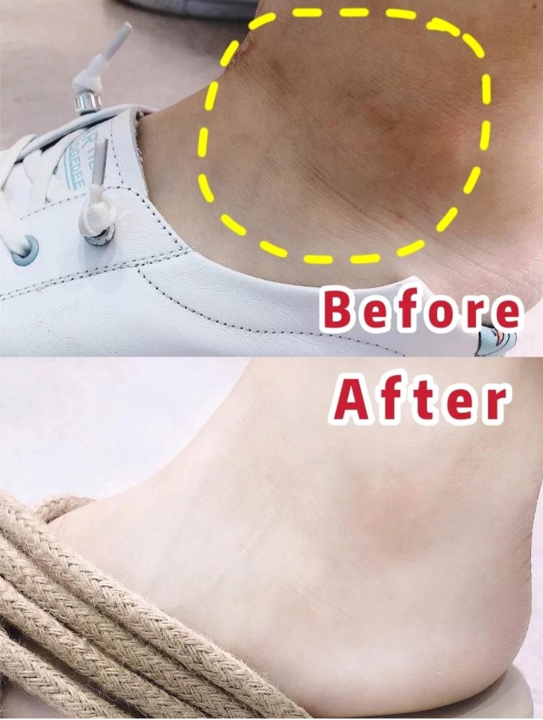 一招告别死皮老茧脚,去脚后跟老茧死皮的法子