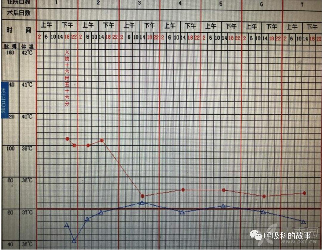 五花八门的发热之一—药物热（1）