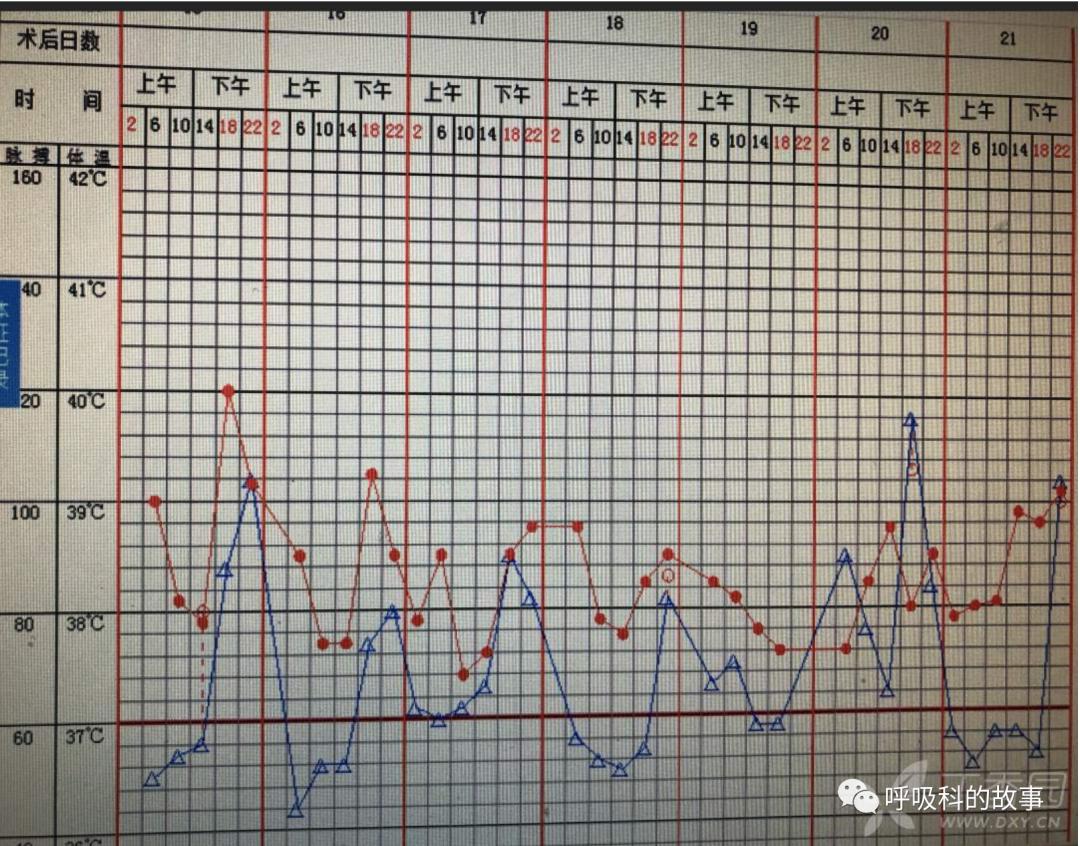五花八门的发热之一—药物热（1）